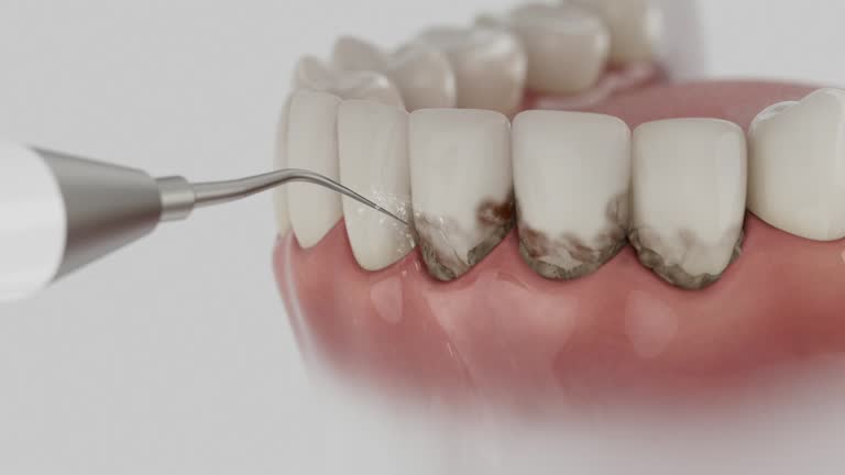 Trusted Teeth Cleaning And Checkup service in Hebron, IL - Dentist Open Now
